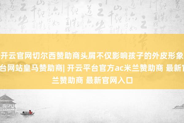 开云官网切尔西赞助商头屑不仅影响孩子的外皮形象-开云平台网站皇马赞助商| 开云平台官方ac米兰赞助商 最新官网入口